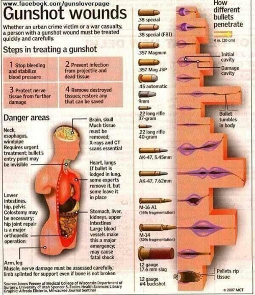 bullet wound treatment